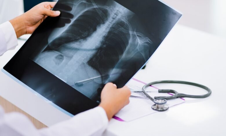 హల్క్ బొమ్మ మింగిన చిన్నారి.. ఎక్స్రేలో కనిపించడంతో డాక్టర్ల షాక్